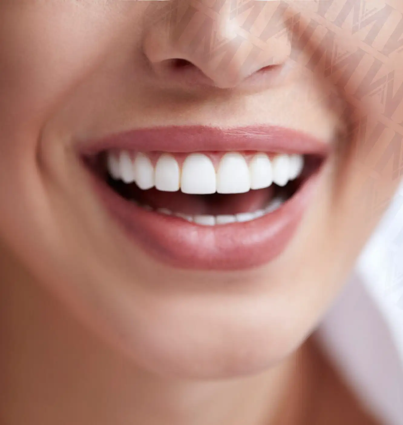 Dental Implant Turkey