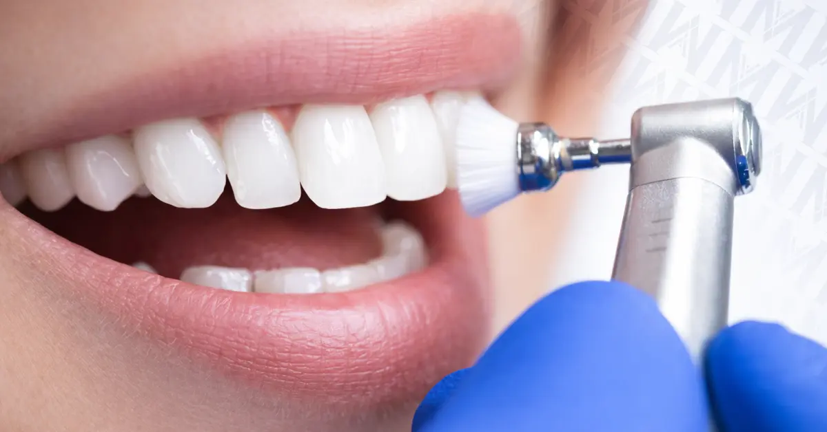 Dental_Cleaning turkey