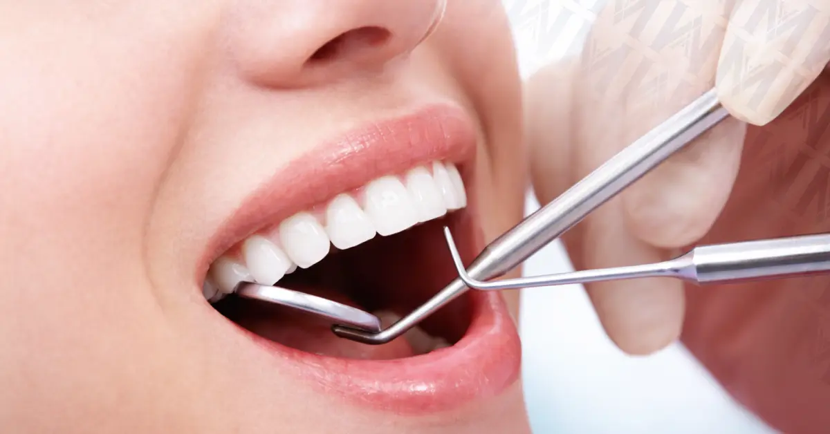 Dental Cleaning